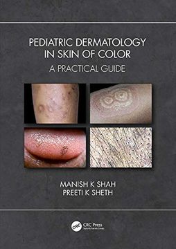 portada Pediatric Dermatology in Skin of Color: A Practical Guide (in English)