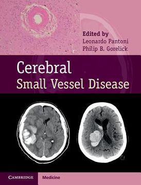 portada Cerebral Small Vessel Disease (en Inglés)