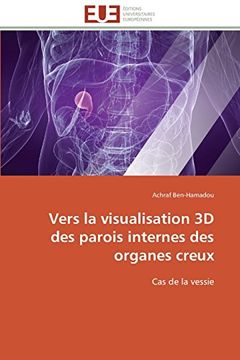 portada Vers La Visualisation 3D Des Parois Internes Des Organes Creux