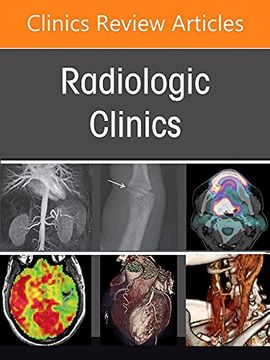 portada Musculoskeletal Imaging of the Older Population, an Issue of Radiologic Clinics of North America (Volume 60-4) (The Clinics: Internal Medicine, Volume 60-4) (en Inglés)