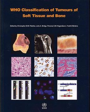 portada who classification of tumours of soft tissue and bone