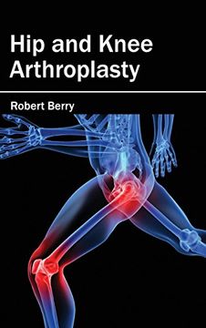 portada Hip and Knee Arthroplasty (in English)