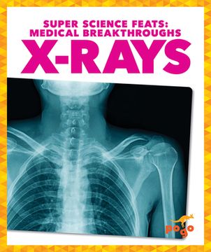 portada X-Rays (Super Science Feats: Medical Breakthroughs) (in English)