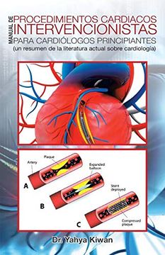 portada Manual de Procedimientos Cardiacos Intervencionistas Para Cardiólogos Principiantes: (un Resumen de la Literatura Actual Sobre Cardiología) (in Spanish)