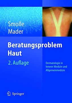 portada Beratungsproblem Haut: Dermatologie in Innerer Medizin und Allgemeinmedizin (en Alemán)