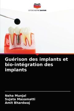 portada Guérison des implants et bio-intégration des implants (en Francés)