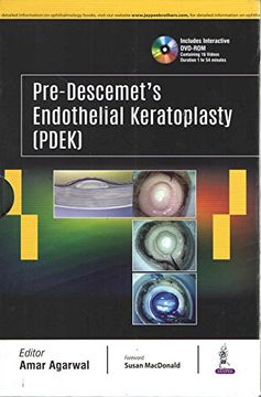 portada Pre-Descemet s Endothelial Keratoplasty (Pdek) (en Inglés)