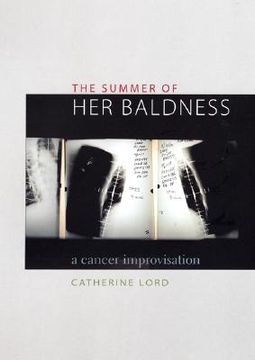 portada the summer of her baldness: a cancer improvisation (in English)