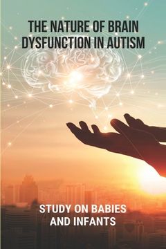 portada The Nature Of Brain Dysfunction In Autism: Study On Babies And Infants: Root Cause Of Autism (en Inglés)