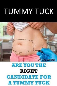 portada Tummy Tuck: Are You The Right Candidate For A Tummy Tuck (en Inglés)