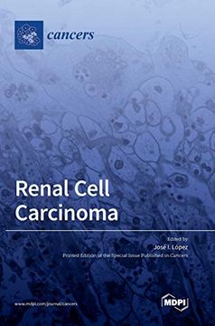 portada Renal Cell Carcinoma (en Inglés)