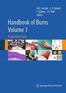 portada Handbook of Burns Volume 1: Acute Burn Care (in English)