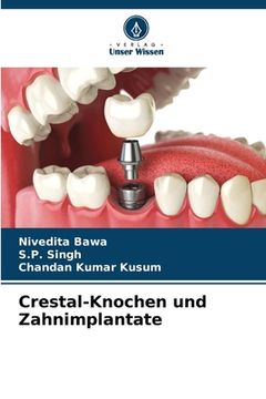 portada Crestal-Knochen und Zahnimplantate