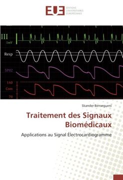 portada Traitement des Signaux Biomédicaux: Applications au Signal Électrocardiogramme (French Edition)