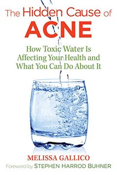 portada The Hidden Cause of Acne: How Toxic Water Is Affecting Your Health and What You Can Do about It