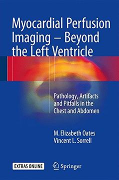 portada Myocardial Perfusion Imaging - Beyond the Left Ventricle: Pathology, Artifacts and Pitfalls in the Chest and Abdomen