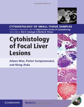 portada Cytohistology of Focal Liver Lesions (Cytohistology of Small Tissue Samples) (en Inglés)