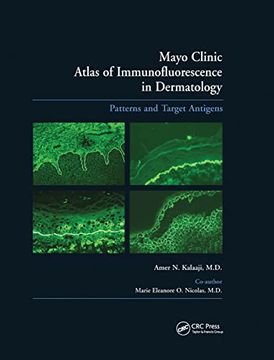 portada Mayo Clinic Atlas of Immunofluorescence in Dermatology: Patterns and Target Antigens (en Inglés)