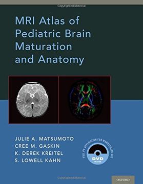 portada Mri Atlas of Pediatric Brain Maturation and Anatomy