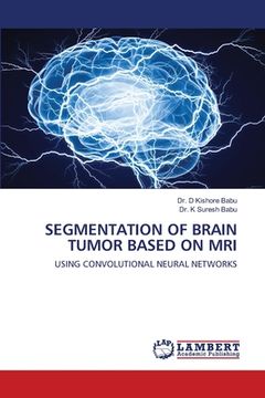 portada Segmentation of Brain Tumor Based on MRI