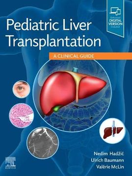 portada Pediatric Liver Transplantation: A Clinical Guide, 1e 