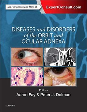 portada Diseases and Disorders of the Orbit and Ocular Adnexa, 1e (in English)