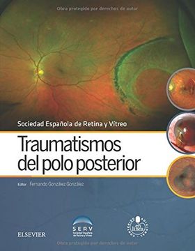 portada Traumatismos del Polo Posterior + Acceso web (in Spanish)