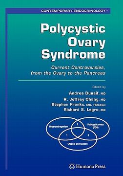 portada polycystic ovary syndrome: current controversies, from the ovary to the pancreas