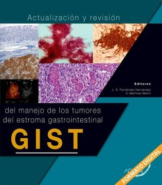 portada Actualizacion y revision del manejo de los tumores del estroma gastrointestinal (in Spanish)