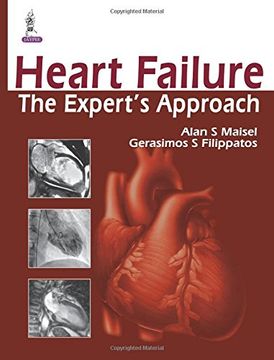 portada Heart Failure: The Expert's Approach