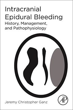 portada Intracranial Epidural Bleeding: History, Management, and Pathophysiology