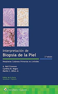 portada Interpretación de Biopsias de la Piel: Neoplasias Cutáneas Primarias No Linfoides (in Spanish)