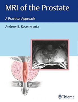 portada MRI of the Prostate: A Practical Approach (in English)