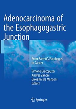 portada Adenocarcinoma of the Esophagogastric Junction: From Barrett's Esophagus to Cancer (en Inglés)