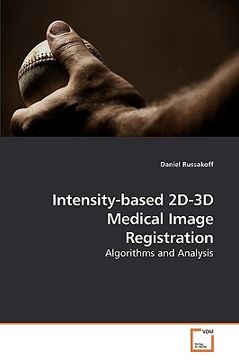 portada intensity-based 2d-3d medical image registration (en Inglés)