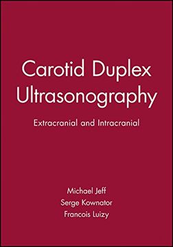 portada Carotid Duplex Ultrasonography
