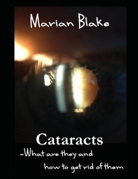 portada Cataracts: What are they and how to get rid of them? (en Inglés)