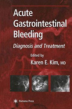 portada Acute Gastrointestinal Bleeding: Diagnosis and Treatment