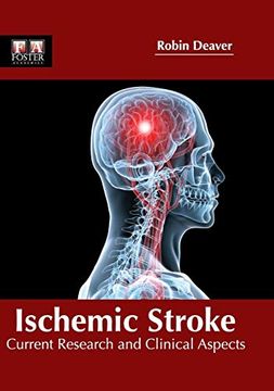 portada Ischemic Stroke: Current Research and Clinical Aspects (en Inglés)