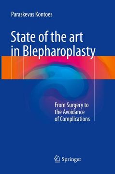 portada State of the Art in Blepharoplasty: From Surgery to the Avoidance of Complications 