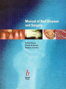 portada manual of nail disease and sur
