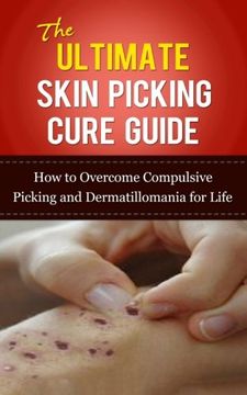 portada The Ultimate Skin Picking Cure Guide: How to Overcome Compulsive Picking and Dermatillomania for Life (Skin Picking Addiction, Pathological Skin. Addictions, Acne, Pimples, Rashes) (en Inglés)