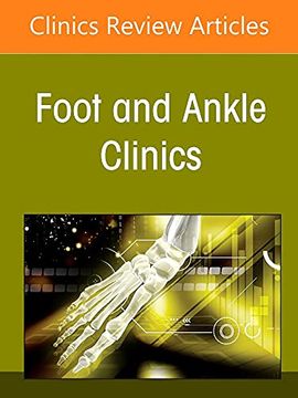 portada Complications of Foot and Ankle Surgery, an Issue of Foot and Ankle Clinics of North America (Volume 27-2) (The Clinics: Internal Medicine, Volume 27-2)