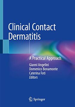 portada Clinical Contact Dermatitis: A Practical Approach (in English)