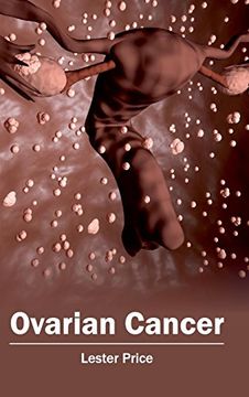 portada Ovarian Cancer (in English)