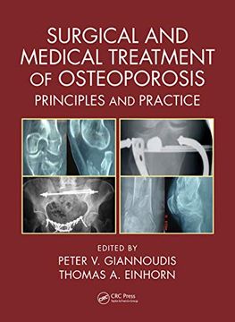 portada Surgical and Medical Treatment of Osteoporosis: Principles and Practice (en Inglés)