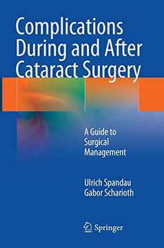 portada Complications During and After Cataract Surgery: A Guide to Surgical Management (en Inglés)