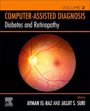 portada Diabetes and Retinopathy (Computer-Assisted Diagnosis) (in English)