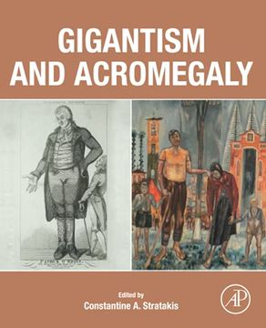 portada Gigantism and Acromegaly: Genetics, Diagnosis, and Treatment (en Inglés)