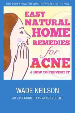 portada Acne: Easy Natural Home Remedies for Acne & How to Prevent It (en Inglés)
